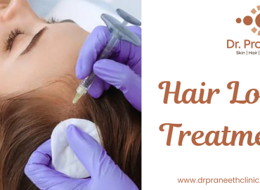 "Best Hair Loss Treatment in Kukatpally - PRP, Transplant, and Expert Care"